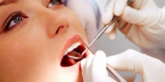 Giới thiệu 6 dịch vụ chăm sóc răng hiện đại tại Nha Khoa Việt Anh